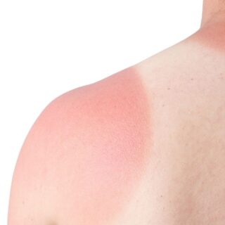 The Ultimate Guide to Home Remedies for Hair Growth