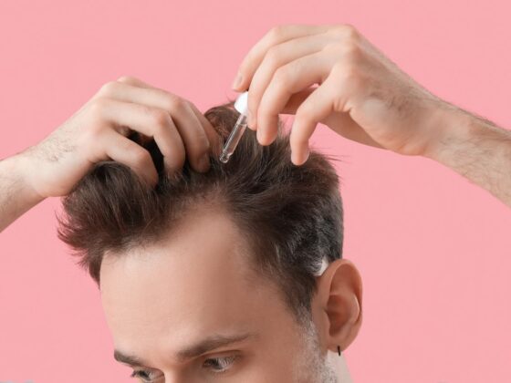 The Ultimate Guide to Home Remedies for Hair Growth